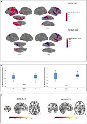 Cortical and Subcortical Network Dysfunction in a Female Patient With NEXMIF Encephalopathy